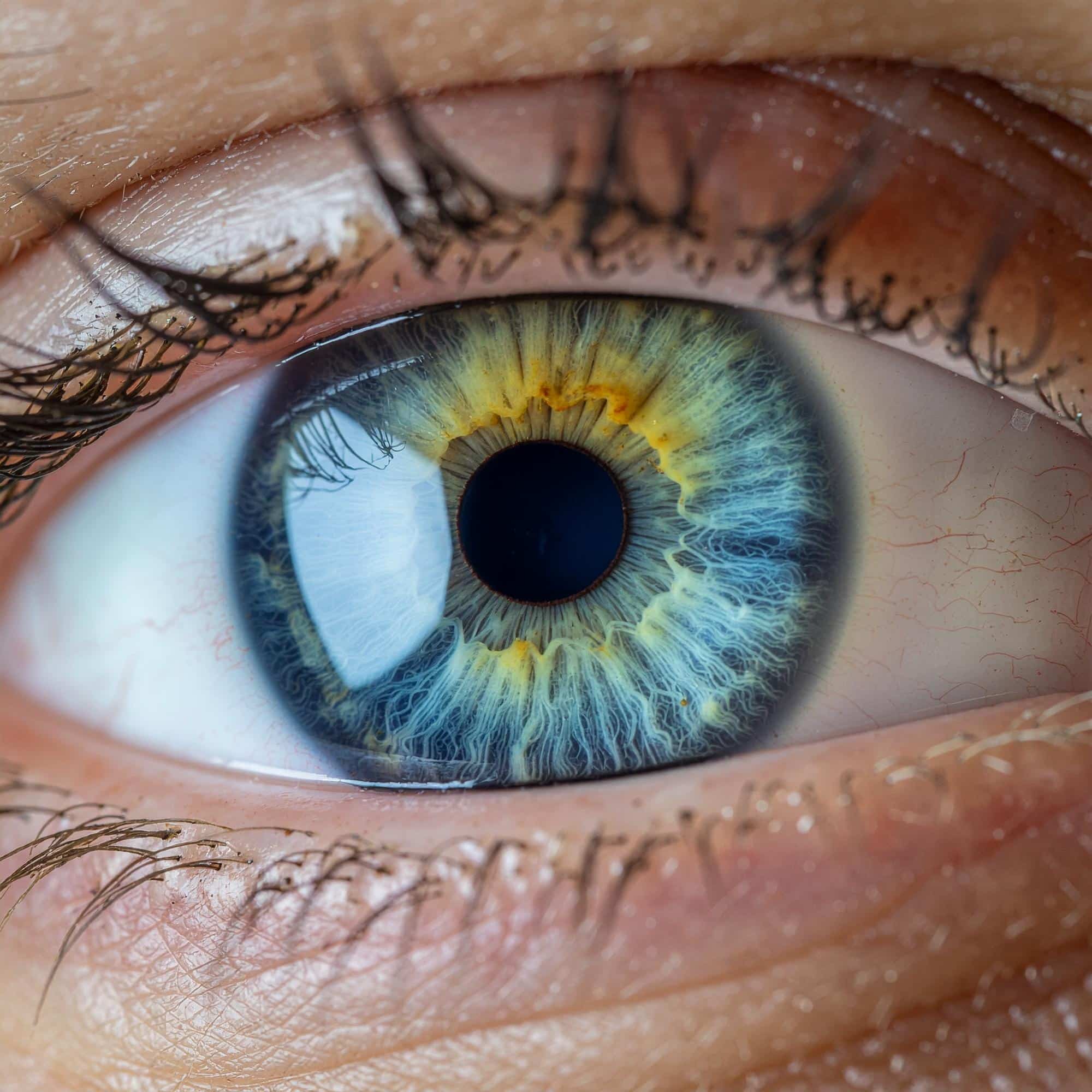 Tag der Netzhaut / World Retina Day 1 Firefly Blaues Gruenes Braunes Auge Iris aus der naehe Nahaufnahme 27115 1